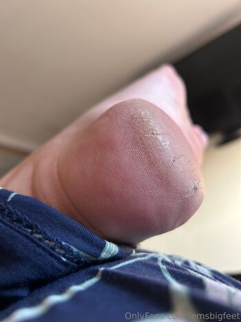jemsbigfeet