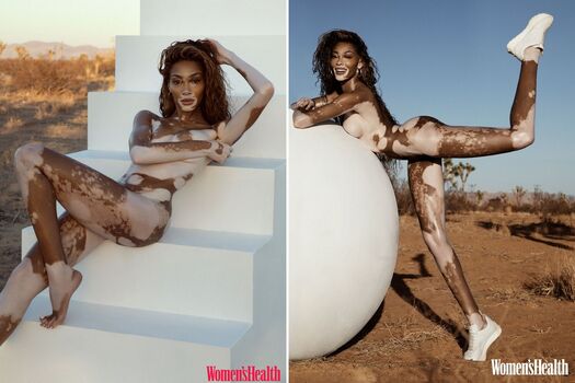 winnieharlow